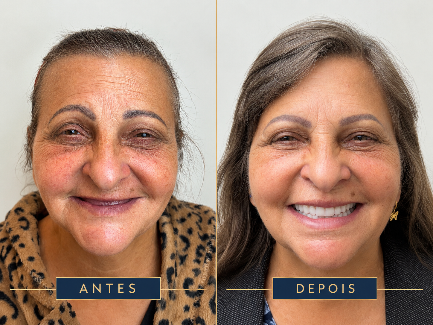 Resultado de tratamento odontológico 1