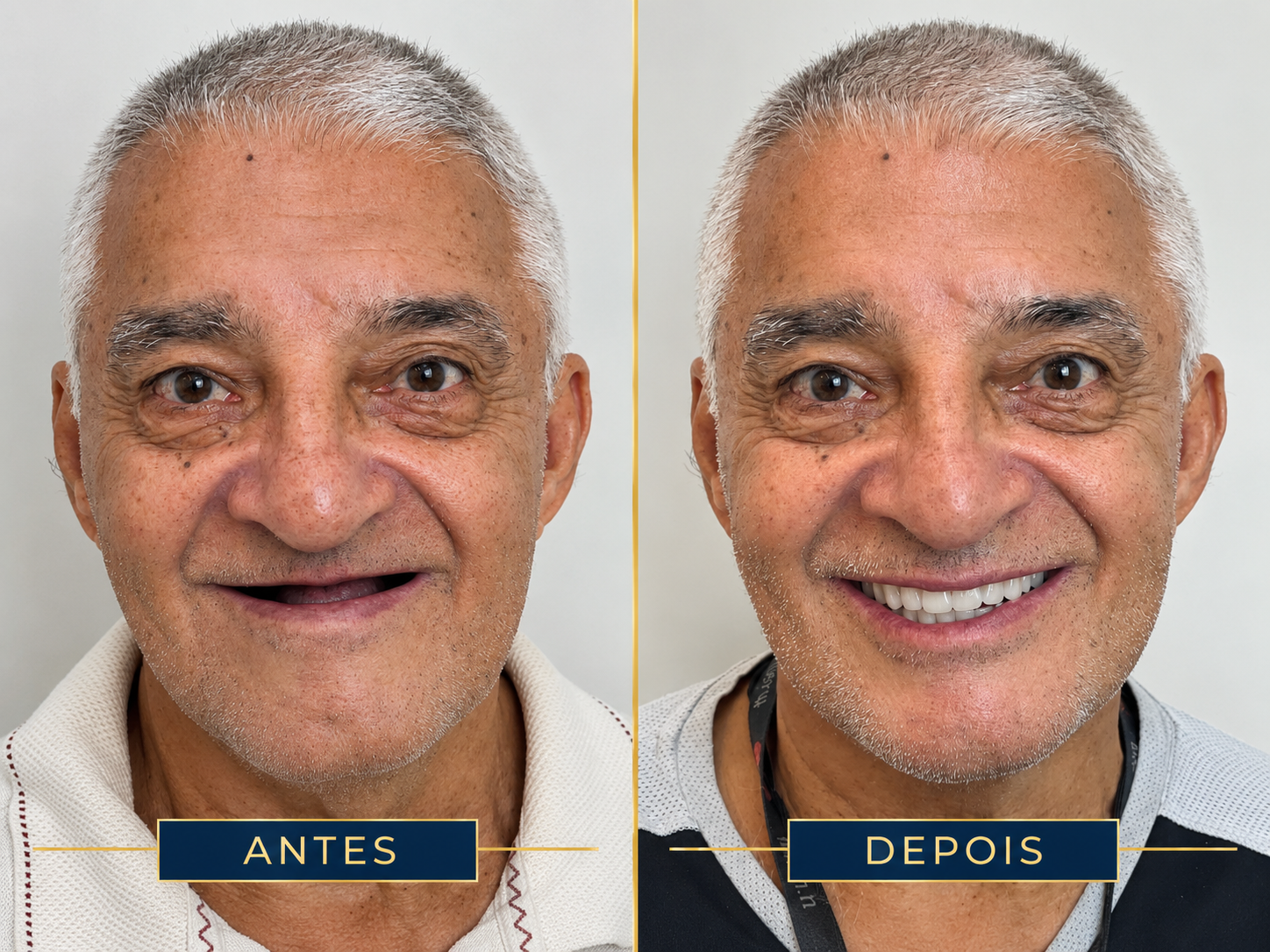 Resultado de tratamento odontológico 2
