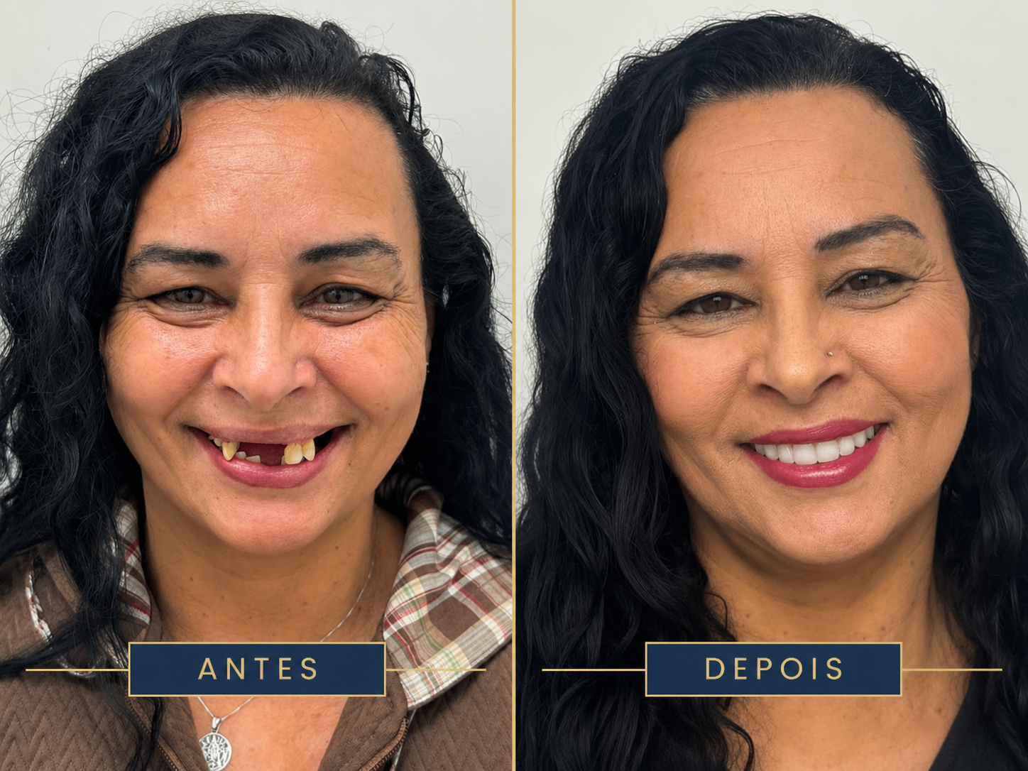 Resultado de tratamento odontológico 3